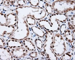 p66 / SHC Antibody (clone OTI3A1)