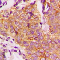 GSK3B / GSK3 Beta Antibody (phospho-Ser9)