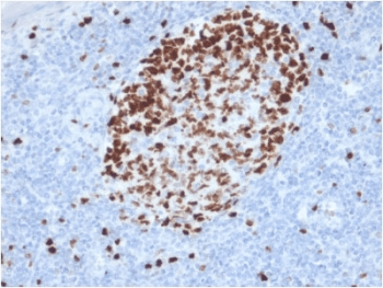 MKI67 / Ki67 Antibody (clone MKI67/2462)