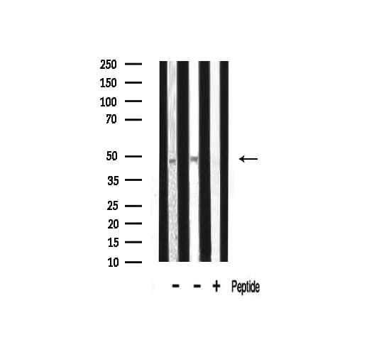 TADA2L / ADA2A Antibody
