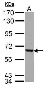 FEM1C Antibody