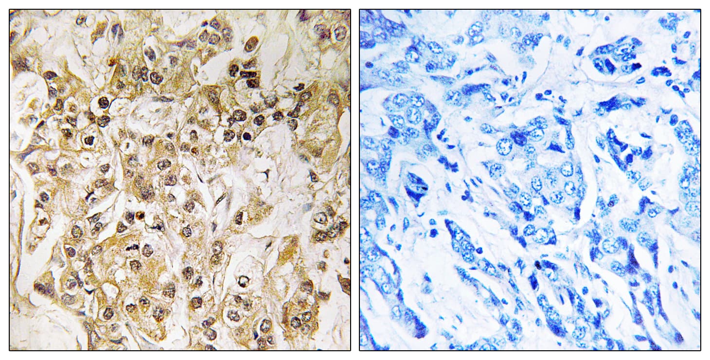 ZNF295 Antibody (aa731-780)