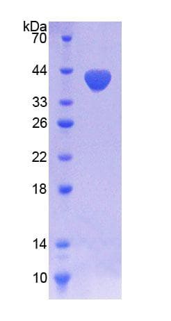 Human NOX5 Protein (Recombinant His-T7)