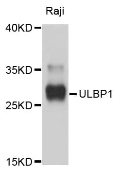 ULBP1 Antibody