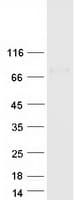 Human PLBD1 Protein (Recombinant Myc-DDK (Flag))