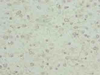 Polyclonal Rabbit anti-Human KCNK13 / THIK-1 Antibody (IHC, WB)