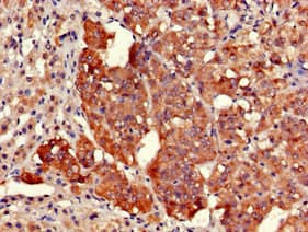 KIAA1970 / EARS2 Antibody