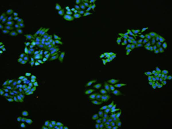 FLT4 / VEGFR3 Antibody