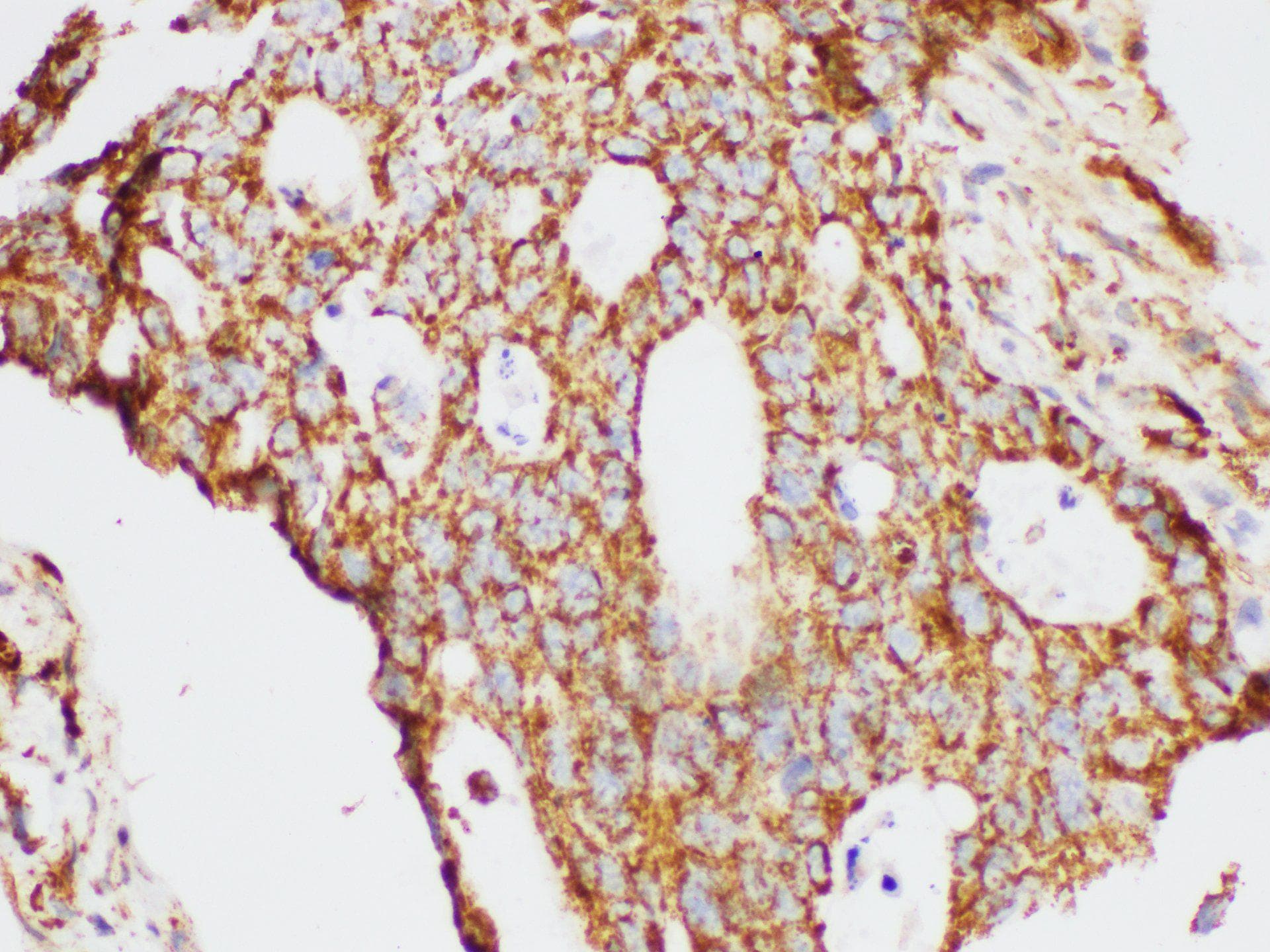 KLK6 / Kallikrein 6 Antibody