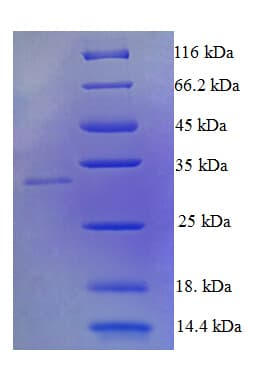 Human TNFSF10 / TRAIL Protein (Recombinant His)