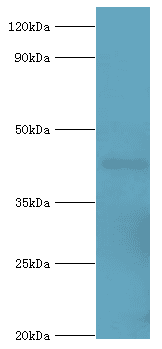 Polyclonal Rabbit anti-Human ACAA1 Antibody (aa27-300, WB)