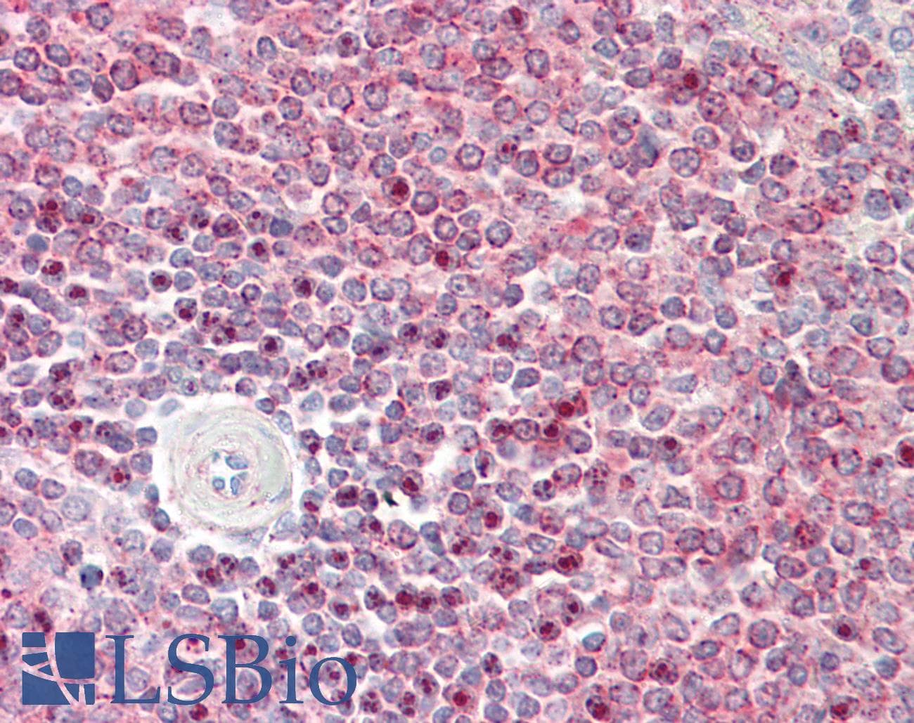 IHC-plus™ Polyclonal Rabbit anti-Human IST1 Antibody (IHC, WB)