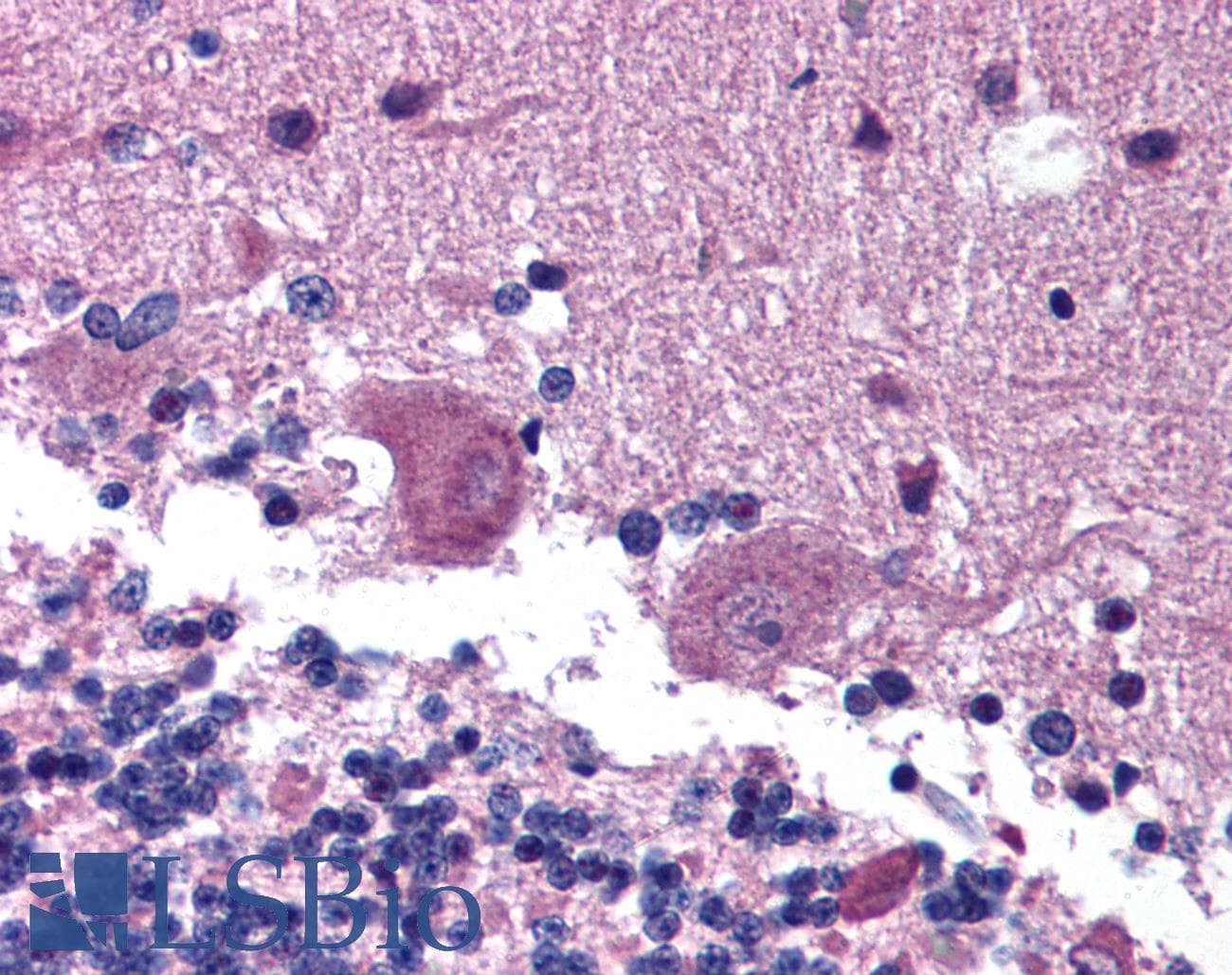 IHC-plus™ ANOS1 / Anosmin Antibody (aa438-454)
