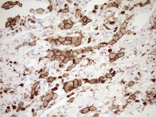 Monoclonal Mouse anti-Human ITGAM / CD11b Antibody (clone OTI2D11, IHC, WB)