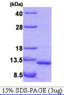 Human VAMP5 / VAMP-5 Protein (Recombinant His)