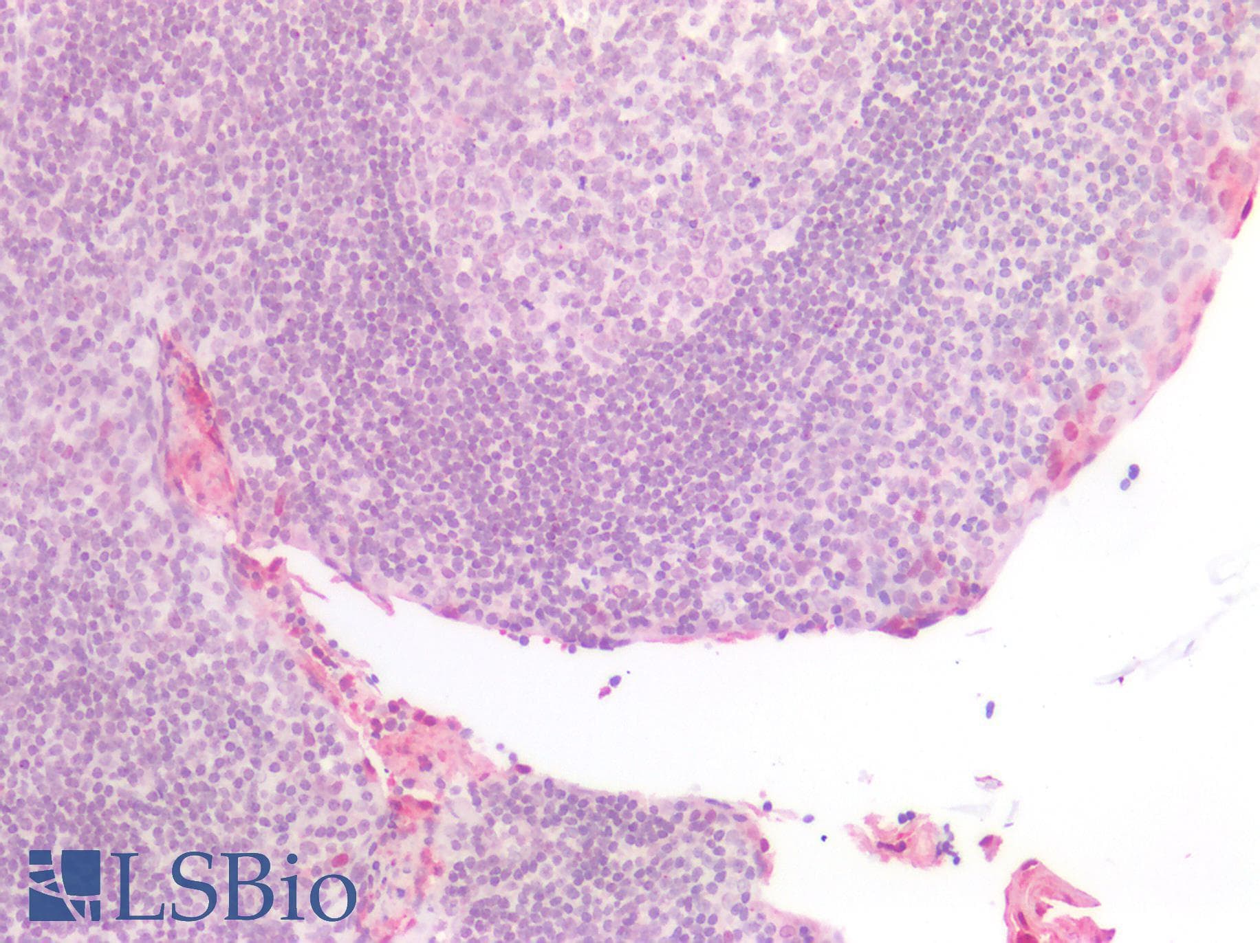 IHC-plus™ Monoclonal Mouse anti-Human S100A8 / MRP8 Antibody (clone CF-145, FITC, IHC, IF, WB)
