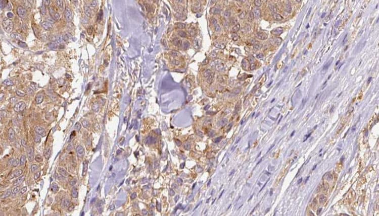 COL4A1 / Collagen IV Alpha1 Antibody