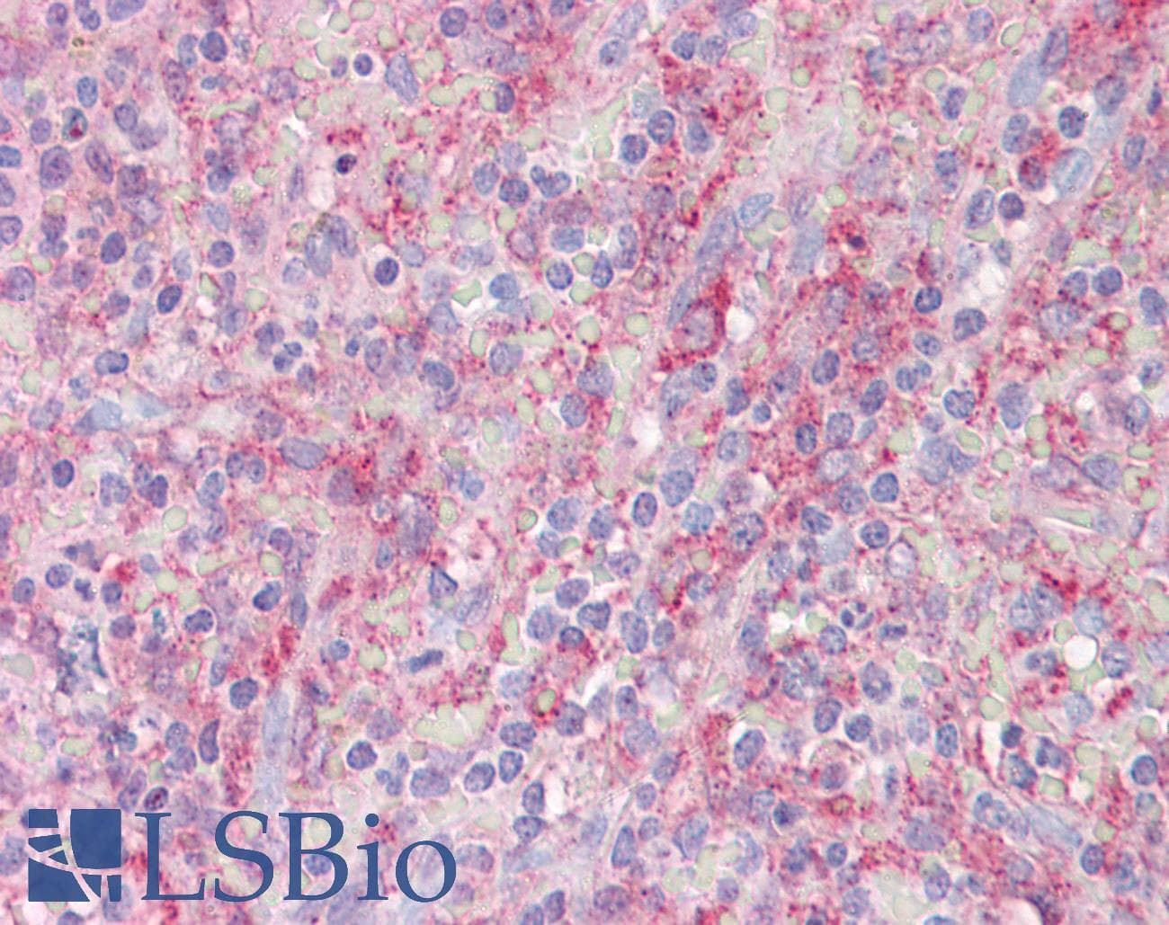 IHC-plus™ CNTROB Antibody (aa591-640)