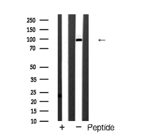 GRM4 / MGLUR4 Antibody