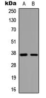 GPR119 Antibody (Internal)