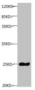 TIMP1 Antibody