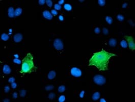 ARH / LDLRAP1 Antibody (clone OTI5A12)