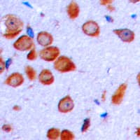 Lymphotoxin-Beta / LTB Antibody (C-Terminus)