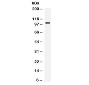CAST / Calpastatin Antibody