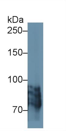 POSTN / Periostin Antibody (aa500-630, APC)