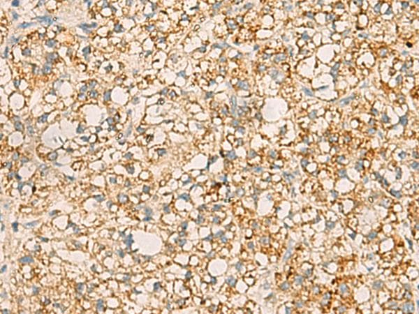 Polyclonal Rabbit anti-Human PDCL Antibody (IHC)