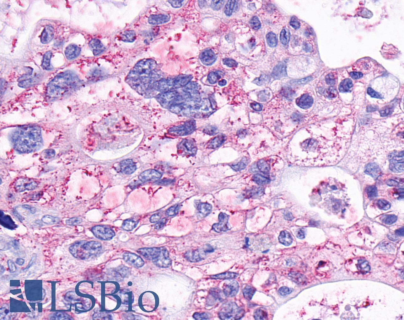 PathPlus™ GPR63 Antibody (C-Terminus)