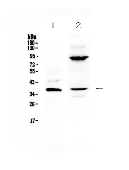 Polyclonal Rabbit anti-Human IL12B / IL12 p40 Antibody (WB)