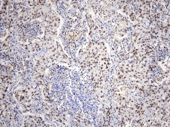 TAF12 Antibody