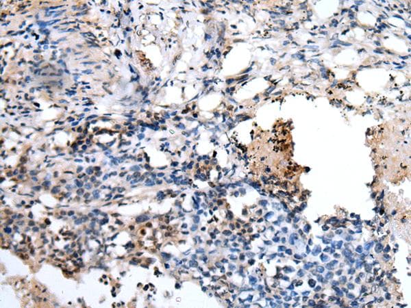 Polyclonal Rabbit anti-Human PPP1R15A / GADD34 Antibody (IHC)