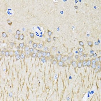 MAP1LC3B / LC3B Antibody