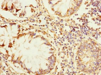 ZP2 Antibody