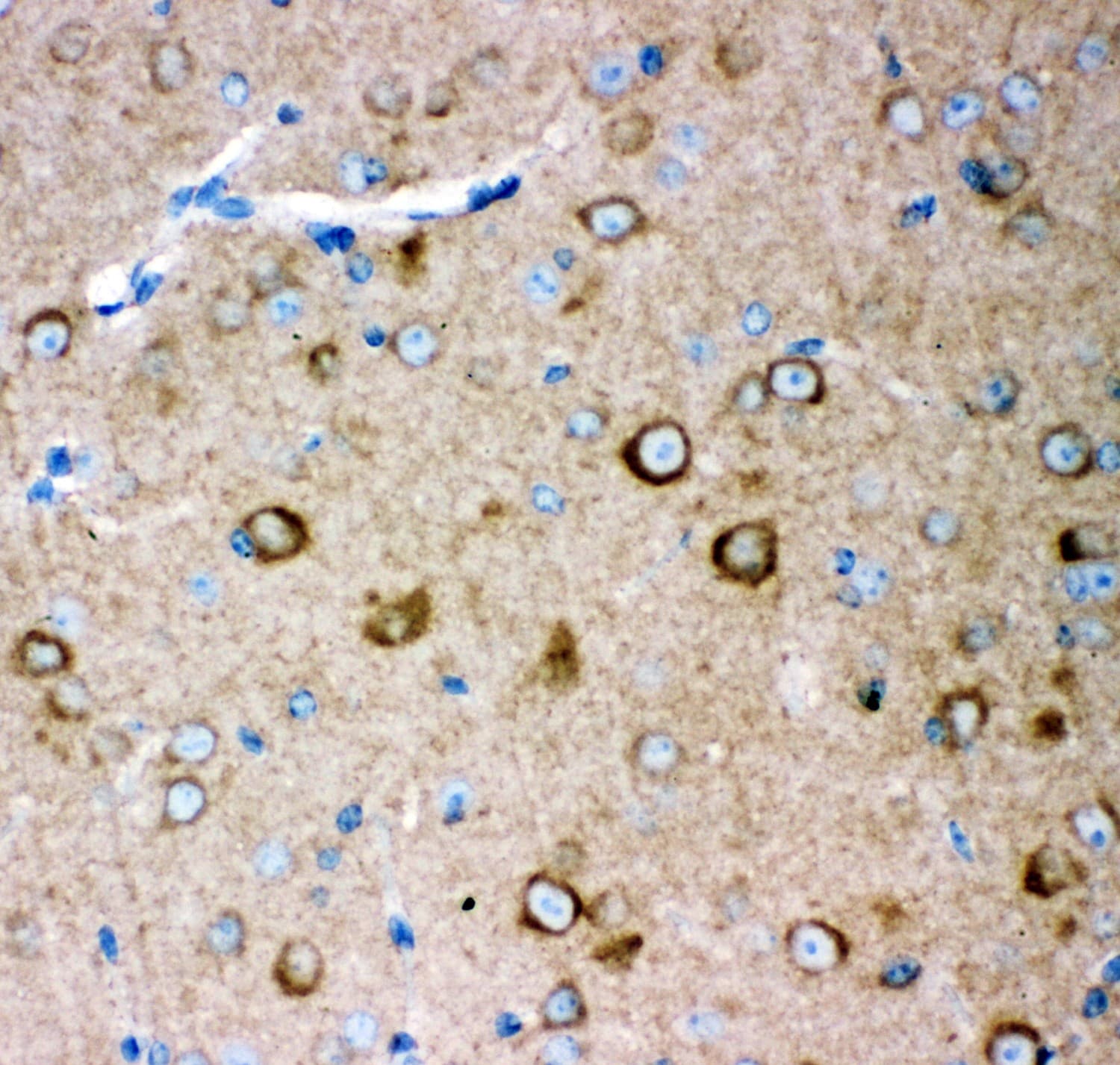 GRIA2 / GLUR2 Antibody (aa25-360)