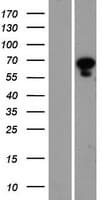 PANK1 / PANK Protein (Over-Expression Lysate Myc-DDK (Flag))