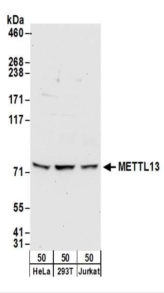 IHC-plus™ Polyclonal Rabbit anti-Human METTL13 / KIAA0859 Antibody (aa650-700, IHC, WB)