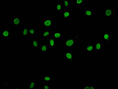 Polyclonal Rabbit anti-Human HIST1H4I Antibody (IHC, IF)