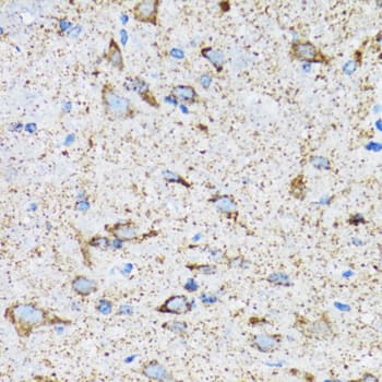 Polyclonal Rabbit anti-Human HSPA9 / Mortalin / GRP75 Antibody (IHC, IF, WB)