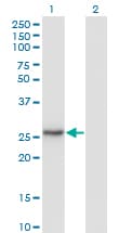NNMT Antibody (clone 2F2)