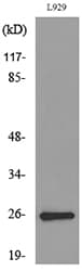 Polyclonal Rabbit anti-Human KLRC1 + KLRC2 + KLRC Antibody (WB)