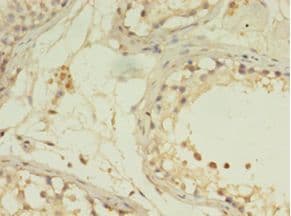 G0S2 Antibody (aa1-103)