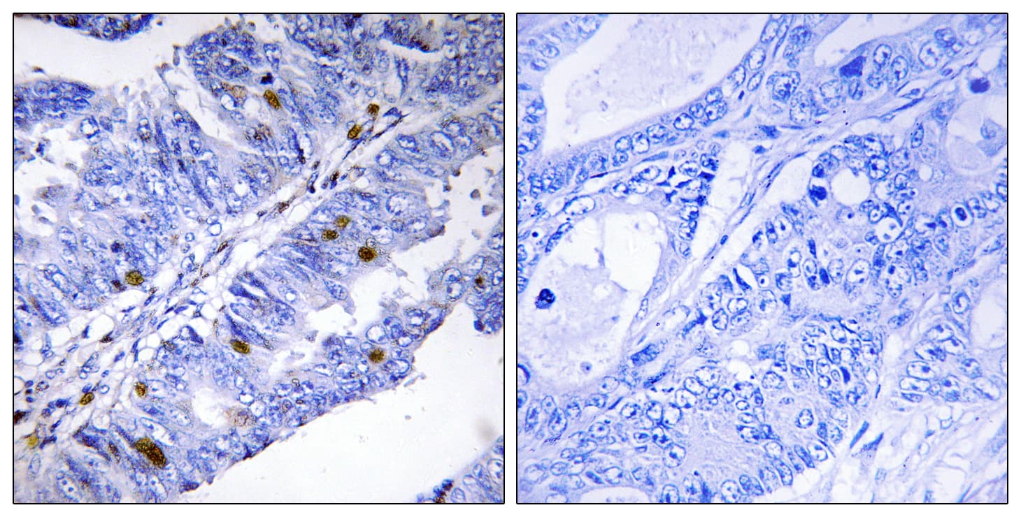 Polyclonal Rabbit anti-Human NR4A1 / NUR77 Antibody (phospho-Ser351, IHC)