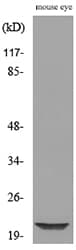 Polyclonal Rabbit anti-Human NIP3 / BNIP3 Antibody (WB)