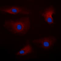 PAK1 Antibody (Internal)