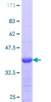 Human NOS3 / eNOS Protein (Recombinant GST, N-terminus)