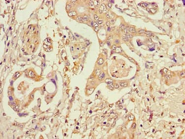 STT3A / ITM1 Antibody