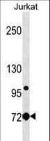 Polyclonal Rabbit anti-Human LCP1 / L-Plastin Antibody (aa306-335, WB)